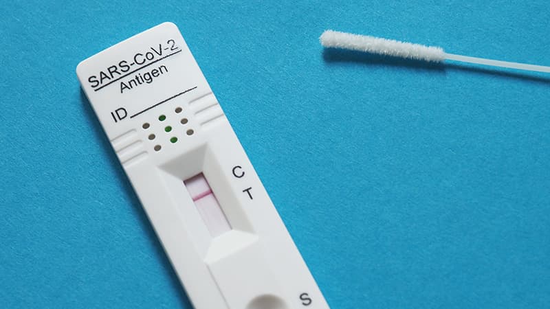 Die Corona-Testpflicht im Arbeitsverhältnis